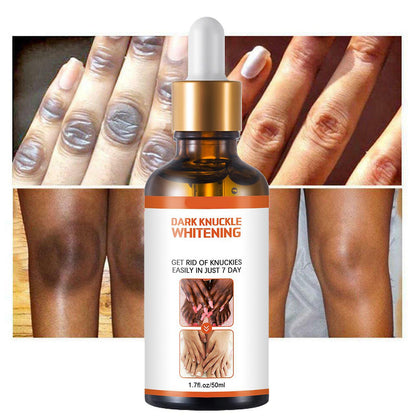 Dark Knuckle Whitening Skin Serum