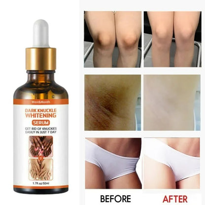 Dark Knuckle Whitening Skin Serum